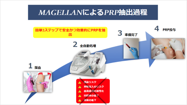 MAGELLANによるPRP抽出過程